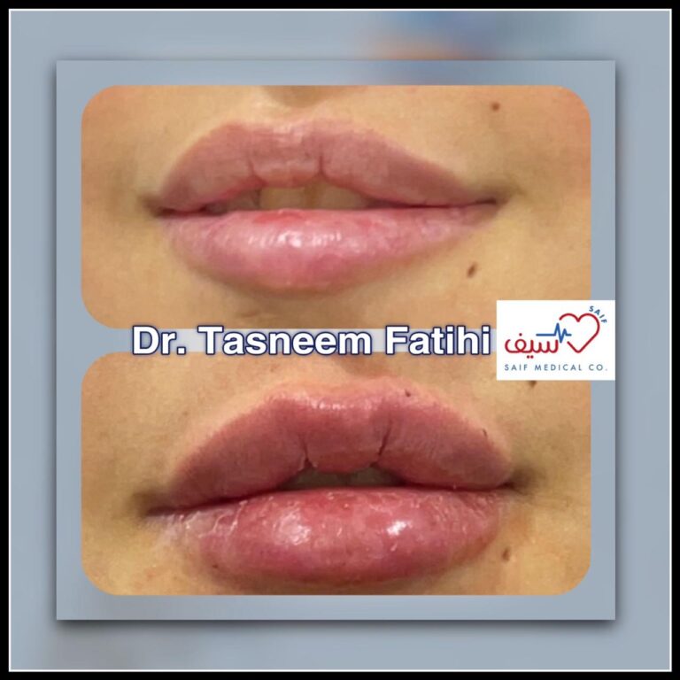 WhatsApp Image 2024-12-21 at 16.39.23_478f6362